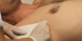 Men's body waxing treatment area